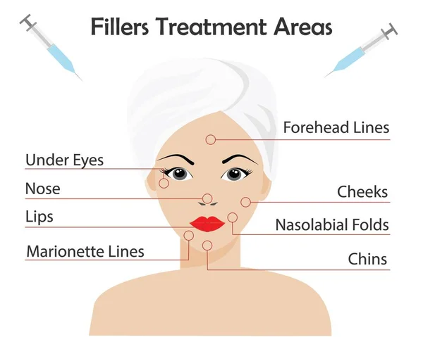 Dermal Fillers Injection Treatment Areas Beautiful Woman Face Red Points — Stock Vector