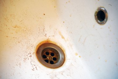 Lavaboda paslı su var. Zararlı musluk suyu sarı akar.                               