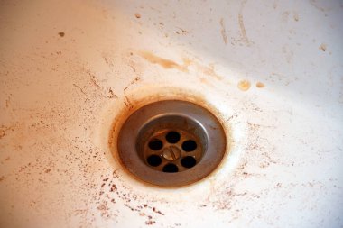 Lavaboda paslı su var. Zararlı musluk suyu sarı akar.                               