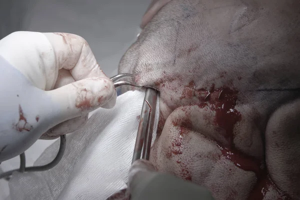 Surgical Scissors In a Head