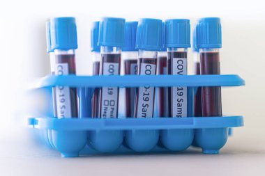 2019 nCoV analizi için üzerinde kan olan test tüpü. Roman covid19 kan testi kavramı.