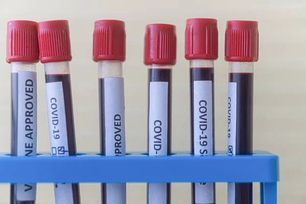 Test Tube Blood 2019 Ncov Analyzing Novel Covid19 Blood Test — Stock Photo, Image