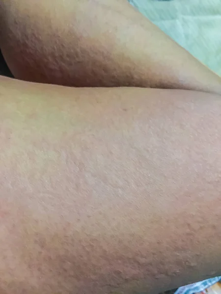 VKontakte-da porno porno