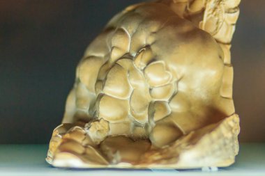 Madencilik ve taşocakçılığı sanayi smithsonite botryoidal alışkanlık kaya örneği. Smithsonite veya çinko spar, çinko karbonat (Znco3), çinko maden cevheri olduğunu.