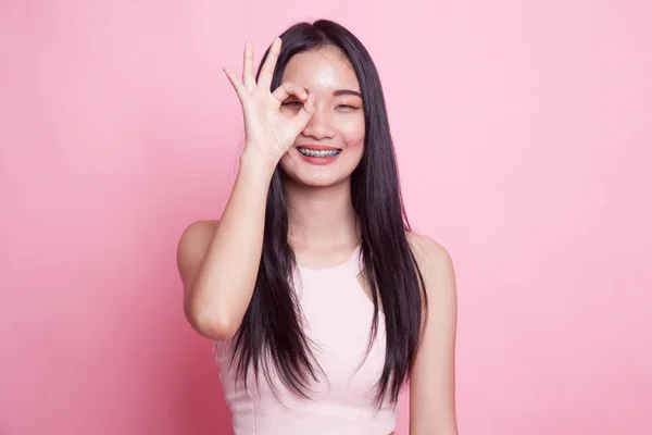 Красивая Молодая Азиатка Показать Знак Поверх Глаза Розовом Фоне — стоковое фото