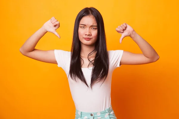 Olycklig Asiatisk Tjej Visar Tummen Ner Med Båda Händerna Ljusa — Stockfoto