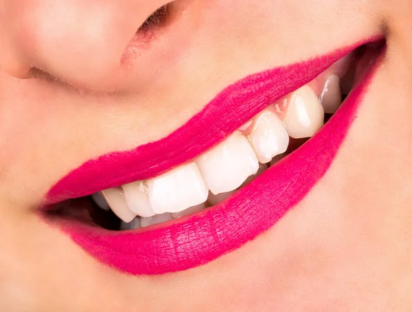 Mulheres Bonitas Sorriem Com Dentes Brancos Close — Fotografia de Stock