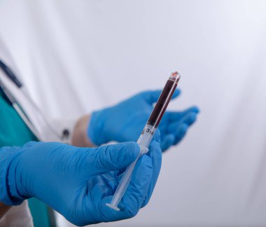 Şırınga kan örneğinle dolu.