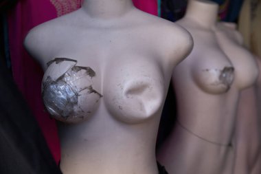 Kadın manken büstünün göğüsleri hasar görmüş.