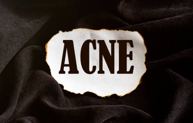 Siyah kumaş arka planında ACNE yazılı yanmış beyaz kağıt parçası.