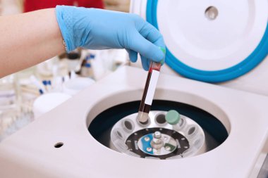 Tube of blood is placed in a medical centrifuge for plasma lifting clipart