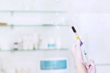 Prp tedavisi ve şırınga doktor için kan plazması
