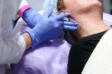 Doktor elinde bir şırınga Mezoterapi kadın bir enjeksiyon yapıyor