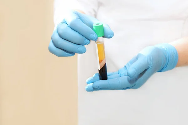 Prp tedavisi, sonra santrifüj cihazı için elinde kan plazması ile tıbbi test tüpü