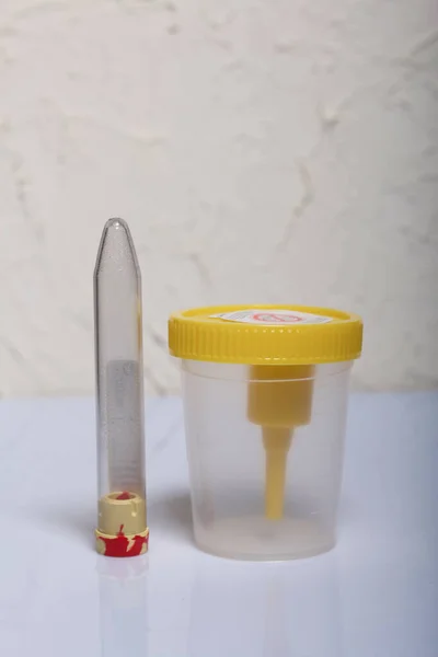 Disposable medical polymeric sterile container with a built-in holder for a vacuum test tube with a screw cap. Container for urine analysis.