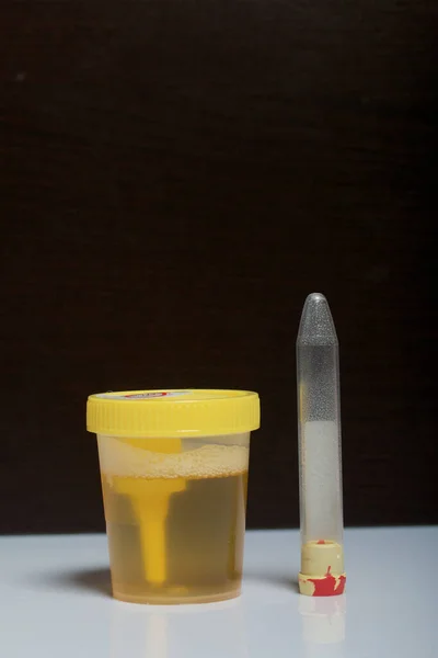 Analiz Için Konteynıra Idrar Tek Kullanımlık Tıbbi Polimer Steril Konteynır — Stok fotoğraf