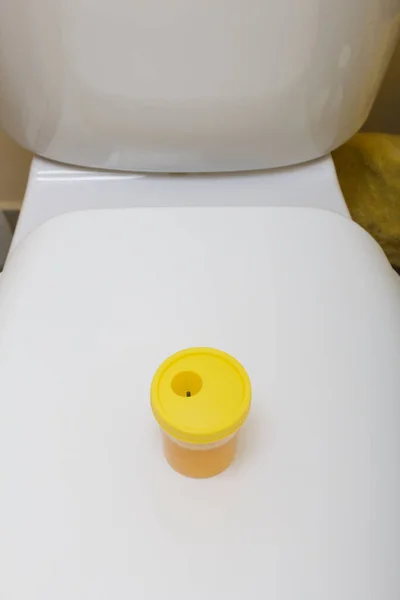 Urine Een Container Voor Analyse Staat Het Toiletdeksel Wegwerpbare Medische — Stockfoto