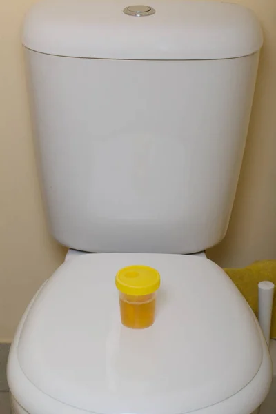 Urine Container Analysis Stands Toilet Lid Disposable Medical Polymeric Sterile — Stock Photo, Image