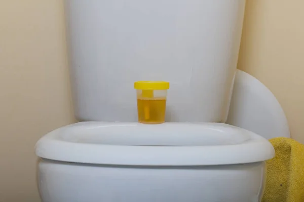 Urine Een Container Voor Analyse Staat Toiletbril Wegwerpbare Medische Steriele — Stockfoto