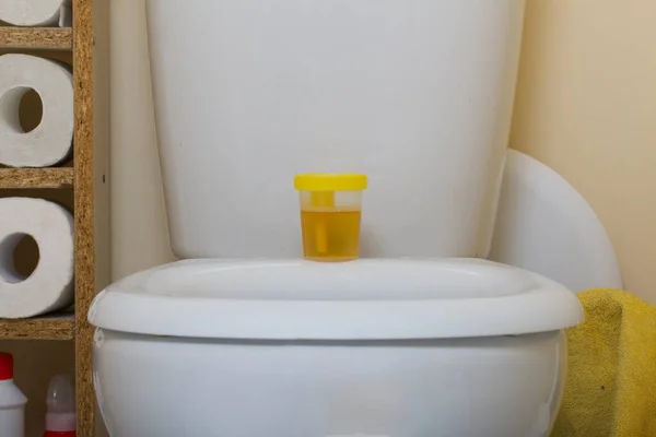 Urine Een Container Voor Analyse Staat Toiletbril Wegwerpbare Medische Steriele — Stockfoto