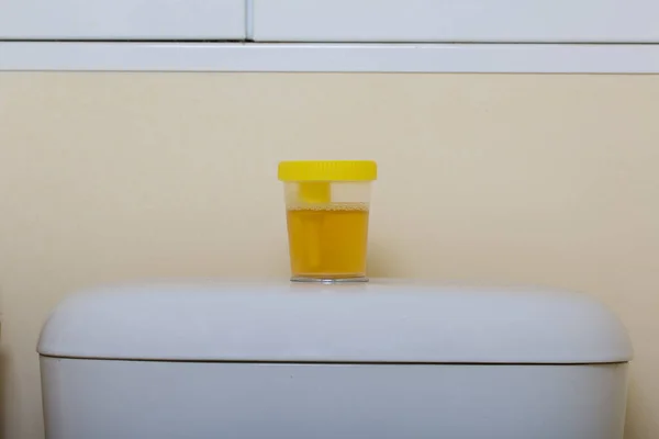分析のための容器に尿 トイレのシスターの上に立つ スクリューキャップ付き真空試験管用の内蔵ホルダー付きの医療用高分子滅菌容器 — ストック写真