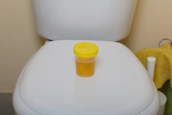 尿液在容器中进行分析 站在马桶盖上 可处置的医用聚合物无菌容器 内置式固定架 用于带有螺杆盖的真空试管 — 图库照片