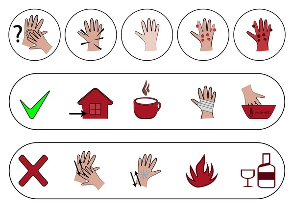 Frostbite Infographics Symptoms Protection First Aid Medical Frostbite Stage Hypothermia — Stock Vector