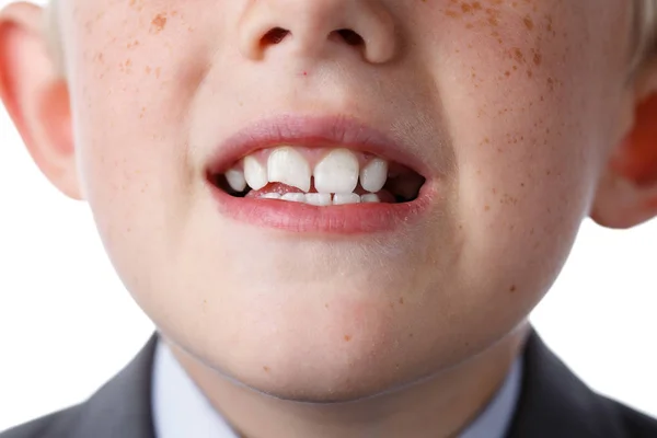 Iskolás a kabát mutatja fogak fehér — Stock Fotó