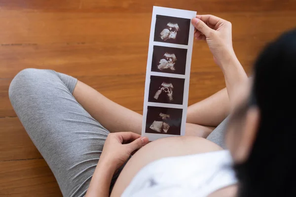 Glad Asiatisk Gravid Kvinna Tittar Ultraljud Bild Medan Röra Magen — Stockfoto