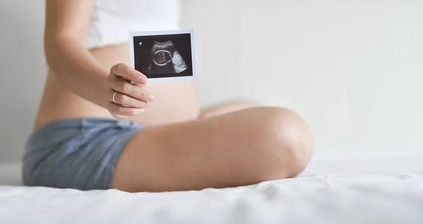 Glad Asiatisk Gravid Kvinna Sitter Visar Ultraljud Bild Medan Sitter — Stockfoto