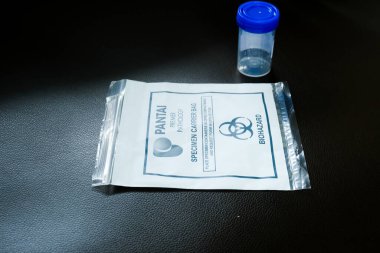 Çocuk virüsü enfeksiyonu için idrar testi.