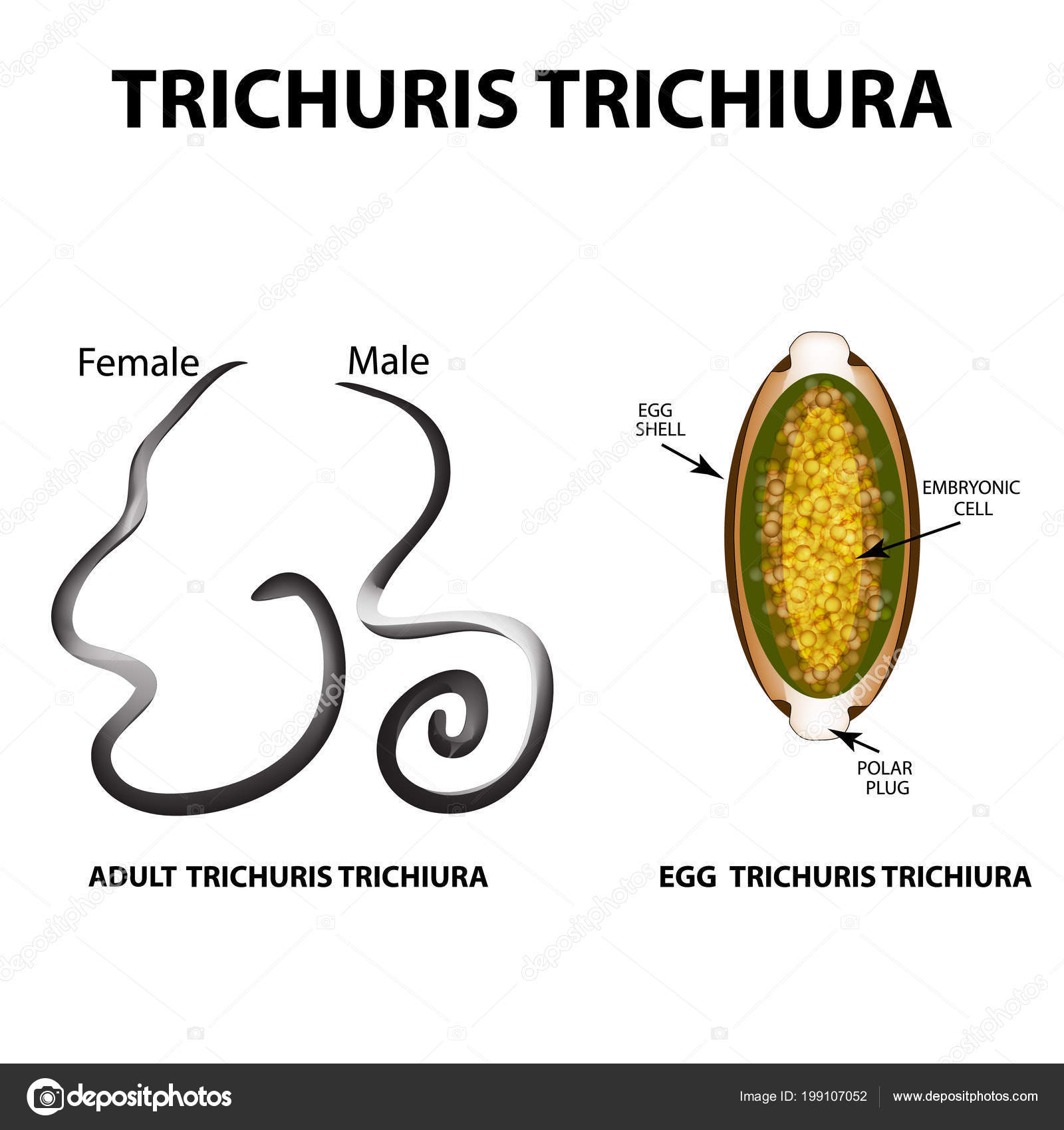 pinworm trichocephalosis)