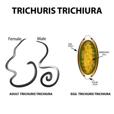 Bir yetişkin Trichuris trichiura yapısı. Yumurta Trichuris trichiura yapısı. Ayarlayın. Infographics. Vektör illüstrasyon izole arka plan üzerinde.
