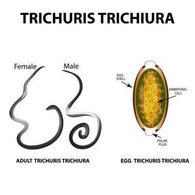 Trichuris trichiura structure of an adult. The structure of the egg Trichuris trichiura. Set. Infographics. Vector illustration on isolated background. clipart