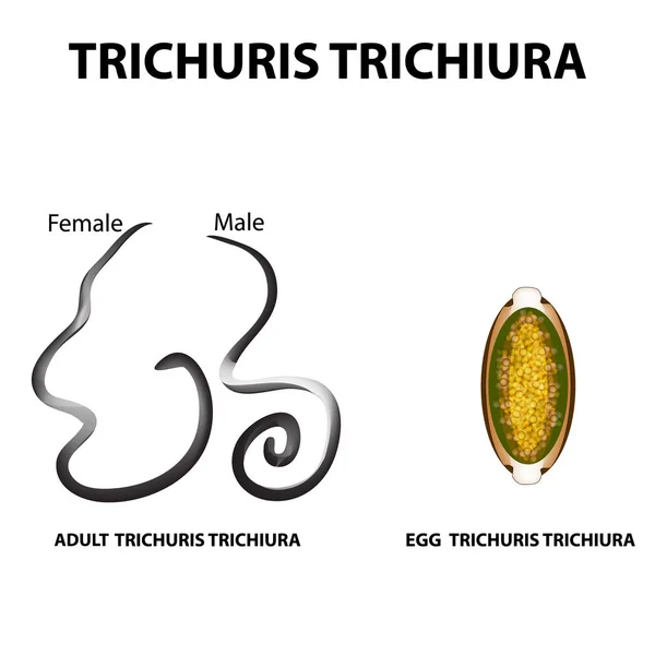 Trichuris trichiura szerkezete egy felnőtt. A tojás Trichuris trichiura szerkezete. Állítsa be. Infographics. Elszigetelt háttér vektor illusztráció. — Stock Vector