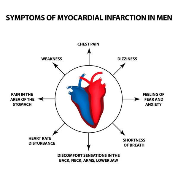 Síntomas de infarto de miocardio en hombres. Un ataque al corazón. Día Mundial del Corazón. Ilustración vectorial sobre fondo aislado — Vector de stock