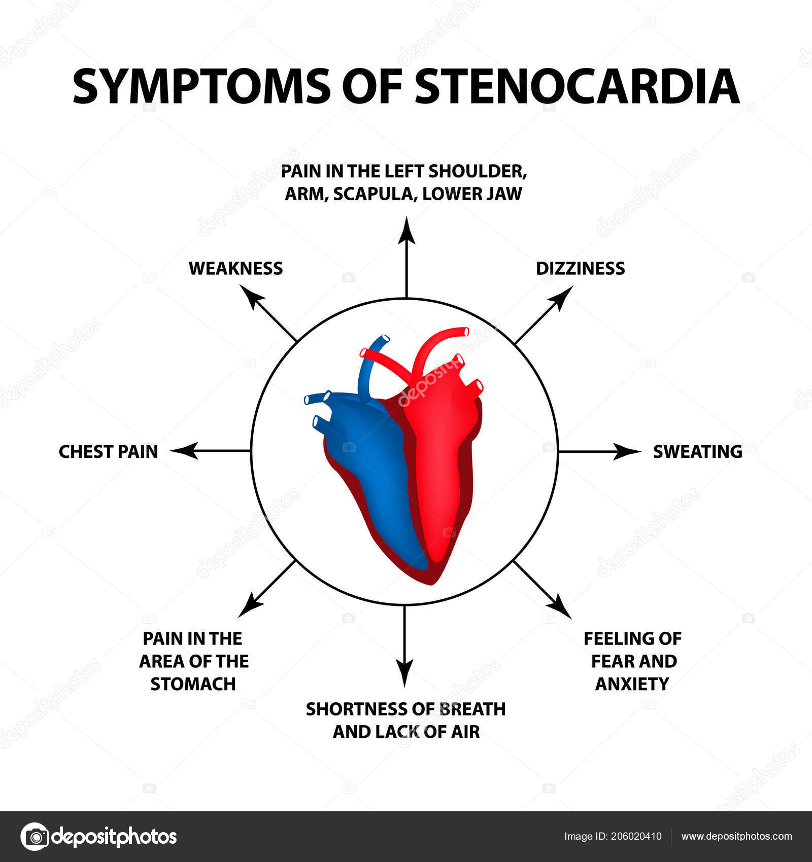 Heart Angina Symptoms What Is Angina Kuchi Heart Angina Symptoms What Is Angina Kuchi