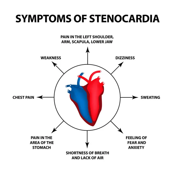 Angina pektoris belirtileri. Kalp hastalığı. Dünya Kalp günü. Vektör illüstrasyon izole arka plan üzerinde. — Stok Vektör