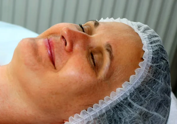 Flicka på det kosmetiska förfarandet. Ansikte rengöring. Fraktionerad föryngring. Botox. Laser resurfacing. Elos lyft. — Stockfoto