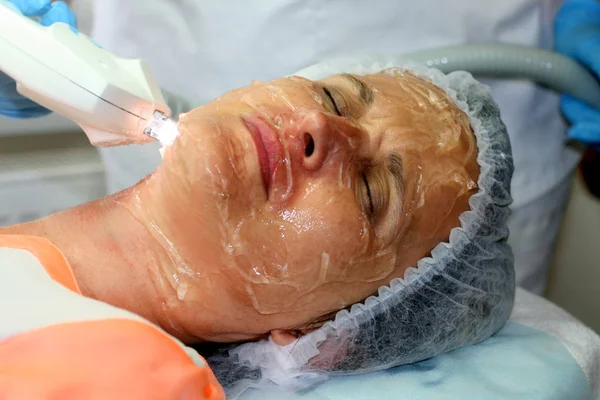 Flicka på det kosmetiska förfarandet. Ansikte rengöring. Fraktionerad föryngring. Botox. Laser resurfacing. Elos lyft. — Stockfoto