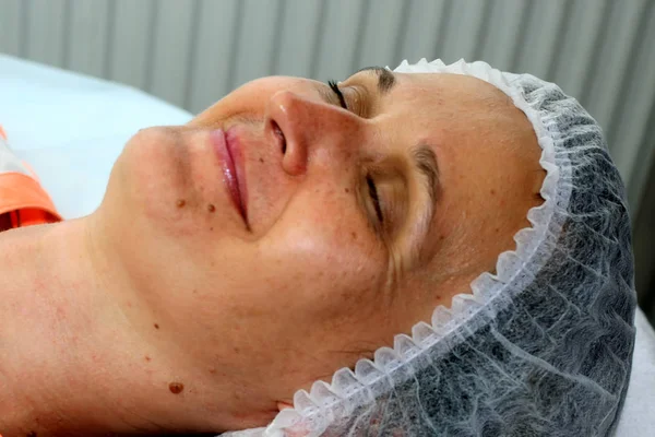 Flicka på det kosmetiska förfarandet. Ansikte rengöring. Fraktionerad föryngring. Botox. Laser resurfacing. — Stockfoto