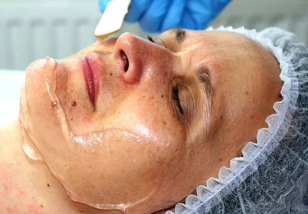 Flicka på det kosmetiska förfarandet. Ansikte rengöring. Fraktionerad föryngring. Botox. Laser resurfacing. — Stockfoto