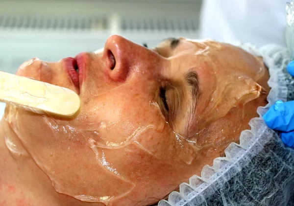 Flicka på det kosmetiska förfarandet. Ansikte rengöring. Fraktionerad föryngring. Botox. Laser resurfacing. Elos lyft. — Stockfoto