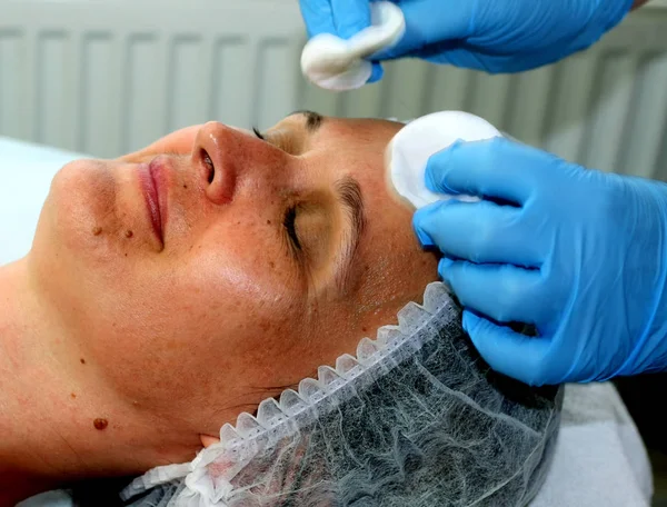 Girl on the cosmetic procedure. Face cleaning. Fractional rejuvenation. Botox. Laser resurfacing. — Stock Photo, Image