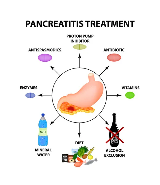 Tratamiento Pancreatitis Estructura Del Estómago Páncreas Infografías Ilustración Vectorial Sobre — Vector de stock