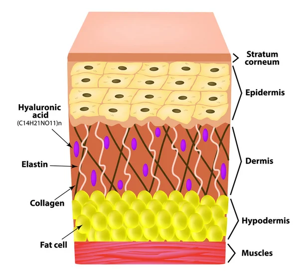 Anatomische Structuur Van Huid Elastine Hyaluronzuur Collageen Infographics Oorzaken Van — Stockvector