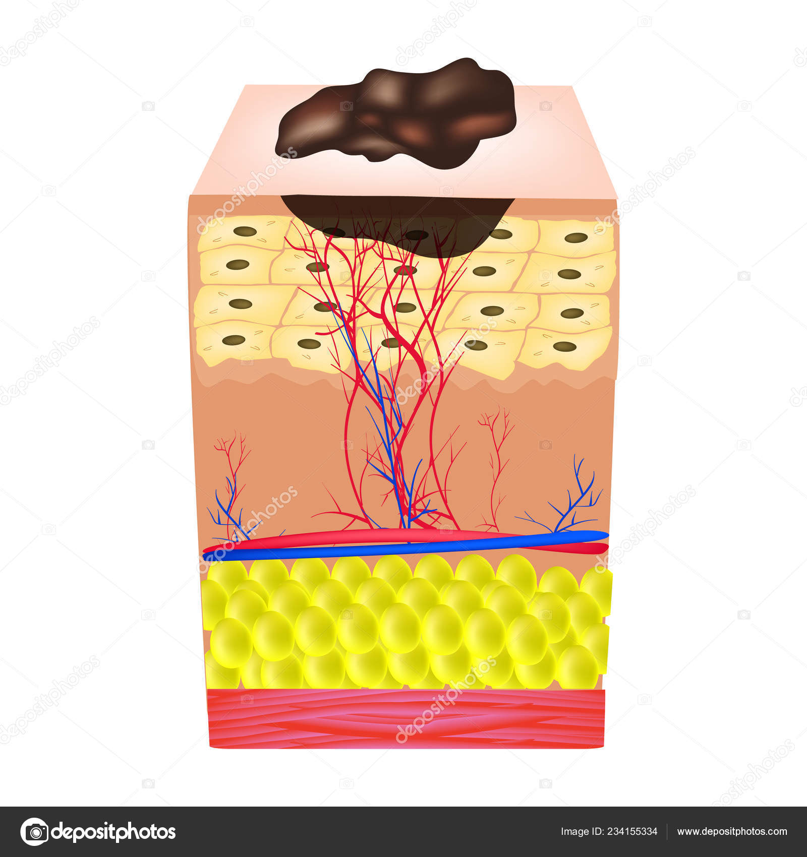 My Image 9
