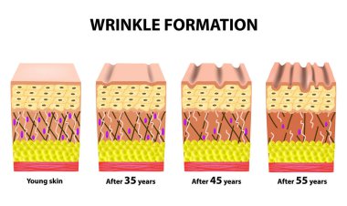 Farklı yaş, kırışıklıkları aşamaları. Cildin anatomik yapısı. Elastin, hyaluronik asit, kollajen. Infographics. yaşlanma cilt. Vektör illüstrasyon izole arka plan üzerinde