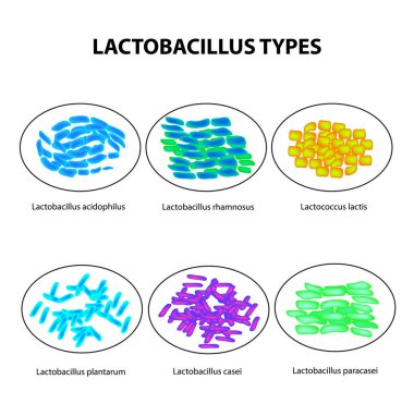 Lactobacilli türleri. Lactobacillus. İyi barsak mikroflorası. Infographics. ayarlayın. Vektör illüstrasyon izole arka plan üzerinde
