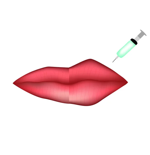 Injections Pour Augmentation Des Lèvres Botox Lèvres Avant Après Procédure — Image vectorielle